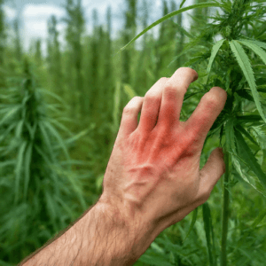 Alergia al Cannabis: Una realidad cada vez mas común mano con enrojecimiento y erupción tocando una planta de cannabis